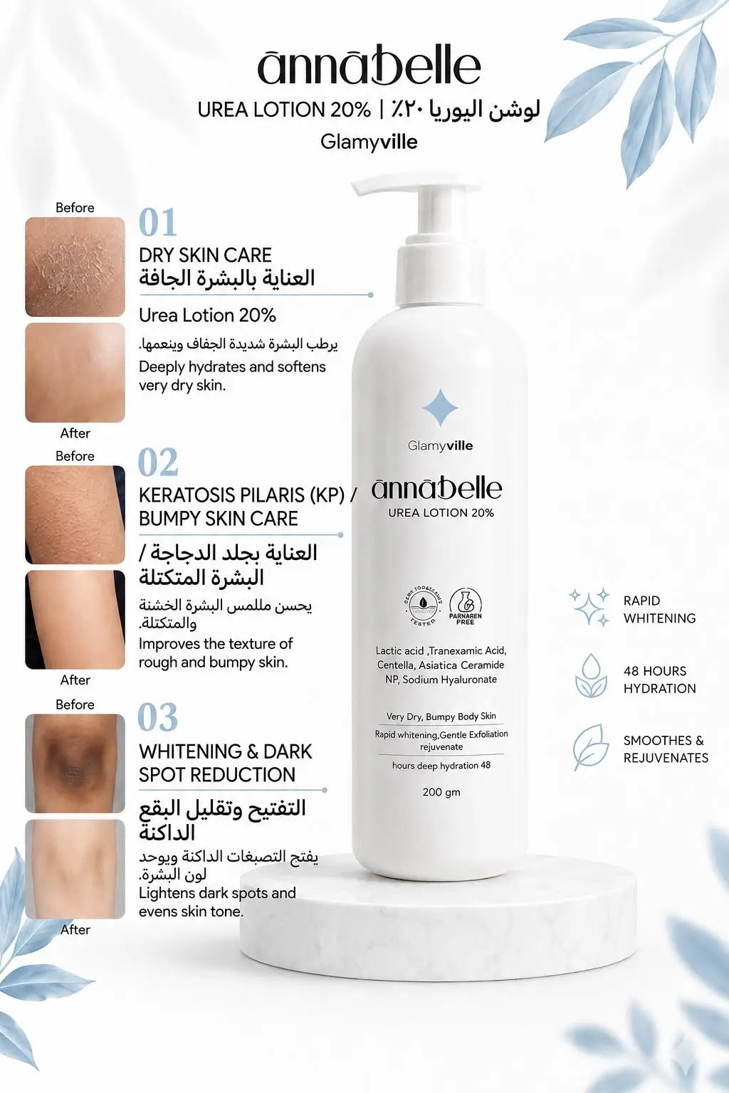 Annabelle Urea Body Lotion 20%