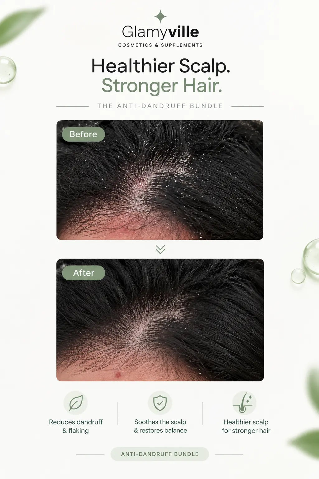 Snap Lap Intensive Anti-Dandruff Bundle